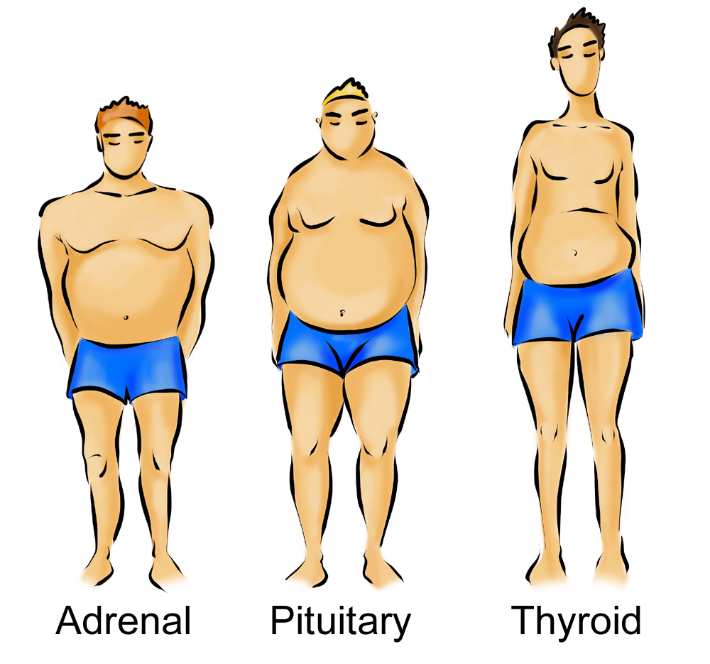 drawing of the 3 male body types,  adrenal, pituitary and thyroid,  to determine what is my body type