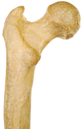 close up of bone structure from bone density test results