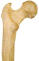 pic of a bone for the link to info on osteoporosis and for your healthy diet plan